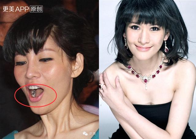 颜好毁在细节上笑出虫牙的女神你爱吗