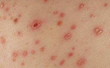 安徽省5城市初中生艾滋病健康教育效果评估