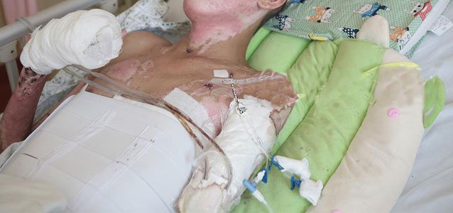 17岁男生昏迷一个月后发现左手被截 浑身绑绷带