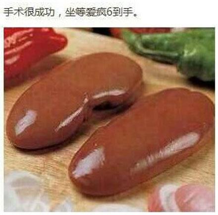 我有一對大腰子,我是果粉我愛裝b.