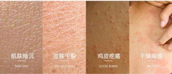 鸡皮肤是什么 总结鸡皮肤的形成原因