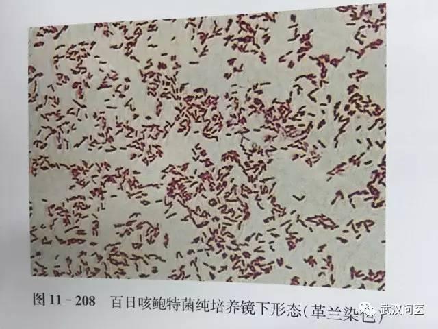 近日,曾经一年难见到的一两例(几乎绝迹)的百日咳又多了起来,而且多得