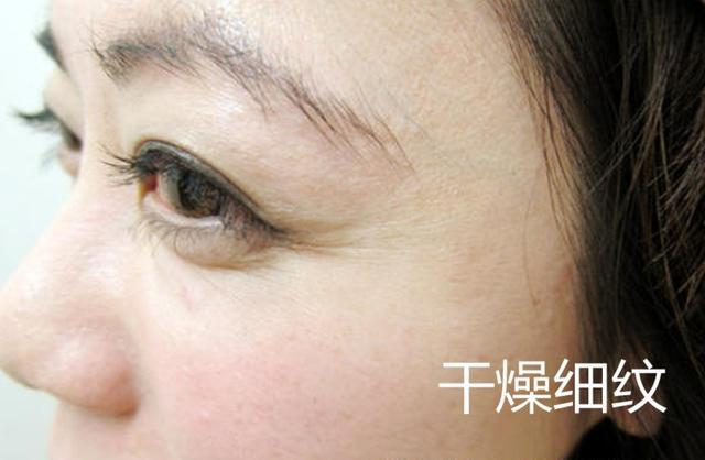 4,皮肤干燥,化妆脱皮,细纹越来越明显?海蓝之谜都改善不了怎么办?