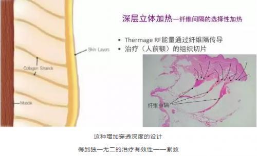 甘肃质监抽查结果 床上用品纤维含量问题突出