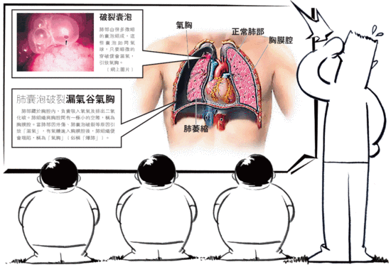 女子針灸治頸椎被刺破肺形成氣胸險喪命 @ 生物活流電治療師elain 的