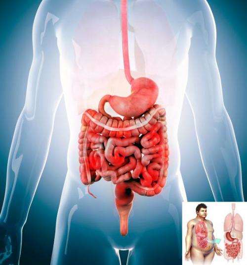 内脏脂肪过多怎么办?让"专家"来帮你