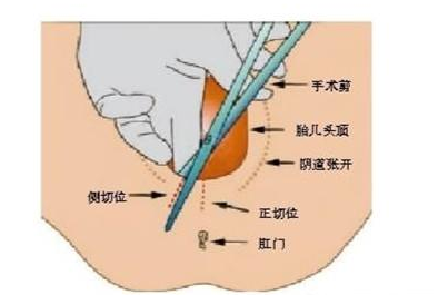 准妈妈临近分娩 你一定要看的13个产前疑问