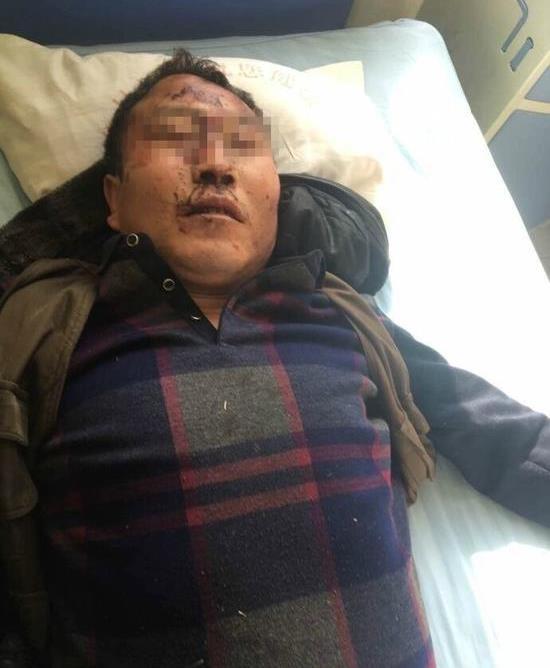 保定一派出所长当街打人?警方这么回应