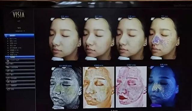 皱纹,纹理,紫外线色斑,毛孔,棕色斑,红色区,紫质等8个角度来进行分析