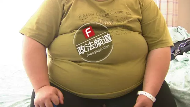 益阳一小伙爱吃垃圾食品 体重飙升至340斤