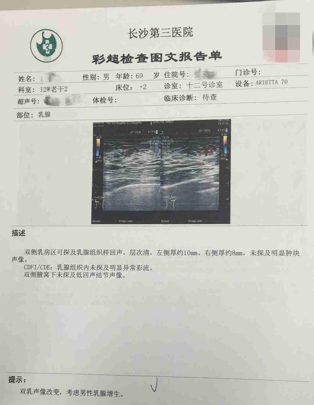 长沙69岁大爷乳房胀痛增大疑似乳腺癌其实祸根只因吃了这个