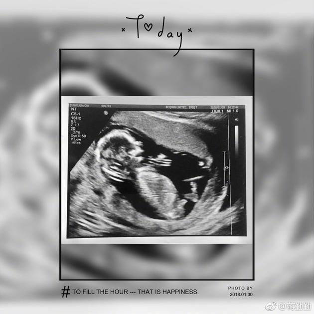 1月31日,4蒋勤勤微博晒出b超照,承认怀二胎喜讯,"很突然很意外,就