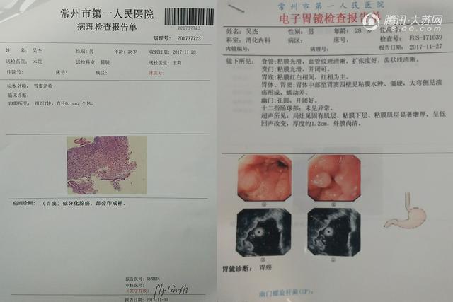 胃癌诊断书p图神器图片