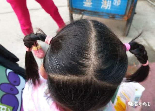 扬州5岁女孩长出密密麻麻白发 背后故事令人心酸