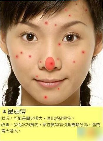 胸部:与长在人中位置的青春痘一样.