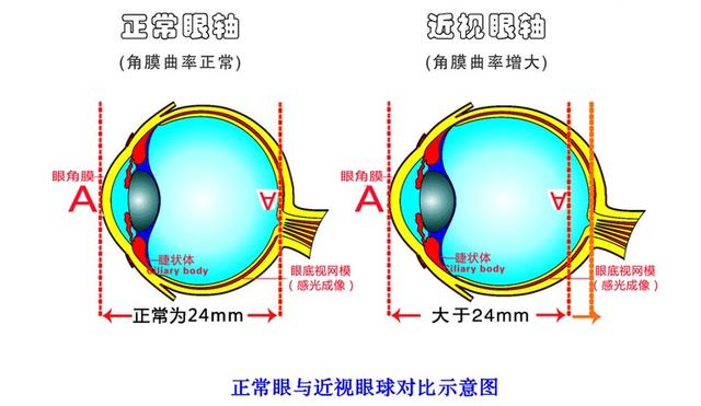 角膜塑形眼鏡多少錢_角膜塑形鏡多少錢一副