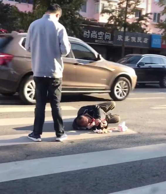 被轿车撞倒 伤者躺在地上淡定玩手机