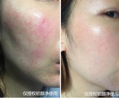 青海皮肤病专科医院：引领皮肤健康新风尚
