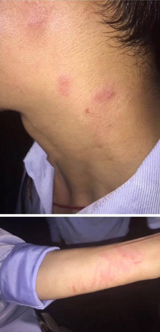 图片说明:迪士尼工作人员被抓伤.网友图