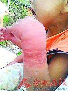 7岁幼女遭亲妈捆绑虐待险死亡 幸得民警相救