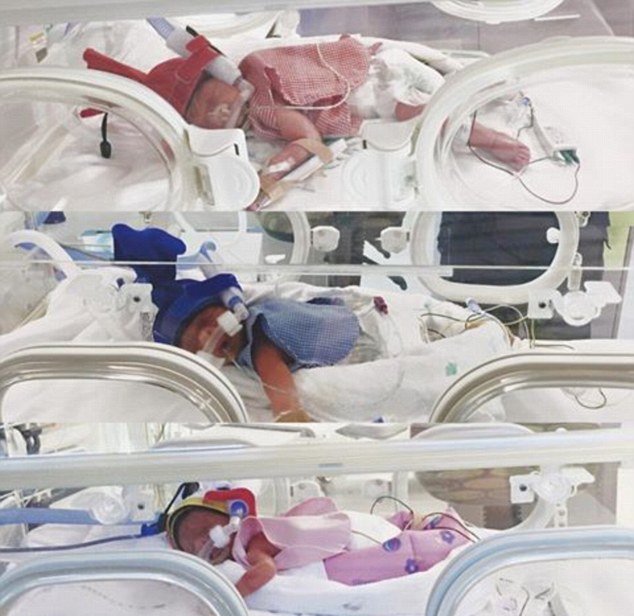 身怀3胞胎母亲为保全虚弱女儿决定早产