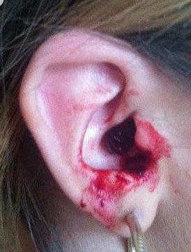 英国少女患神秘怪病每天五孔流血半小时