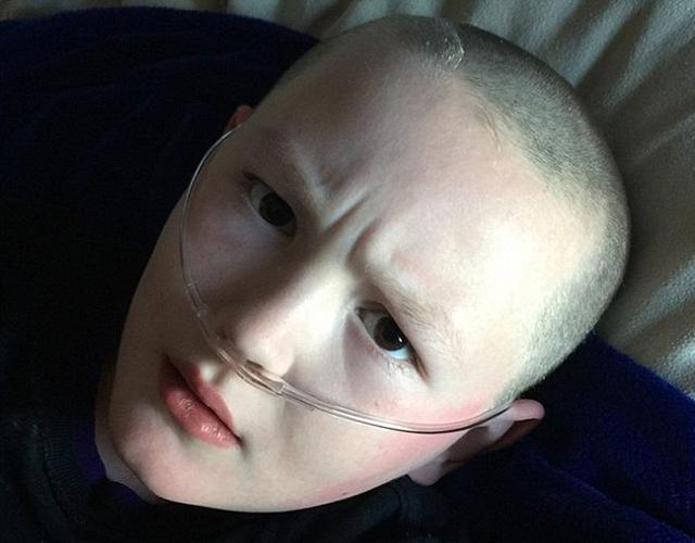 美国10岁男孩患罕见病 慢慢变成"石头"(图)