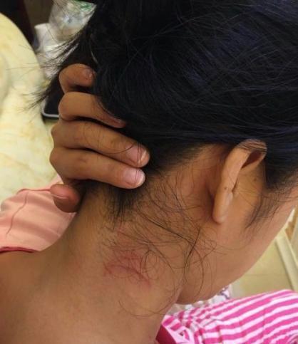 广西3领导席间施暴作陪女子 被斥酒后无德遭查