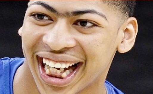 新科状元畸形牙齿曝光犬牙交错类似狼人图