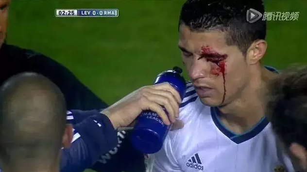 [超清]意大利接连远射轰炸 硬汉特里裆部堵枪眼