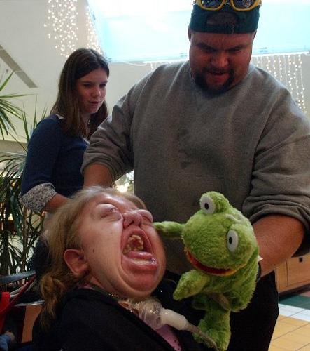 人类最罕见病变:"珊瑚人"和无色人种(图)