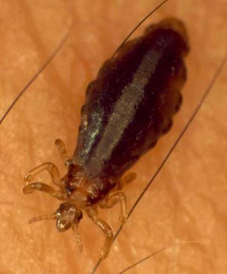 dna分析虱子发现17万年前人类开始穿衣服图