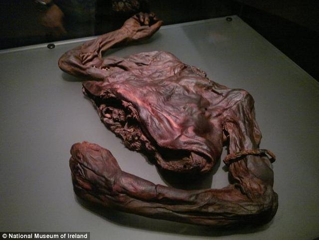 这是2003年在爱尔兰沼泽区挖掘发现的一具保存完好的铁器时代尸体,一