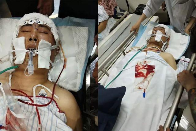 天津外卖小哥倒在血泊中 浑身插满管子