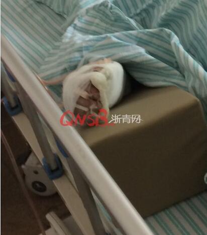 触目惊心！杭州一女员工被传送带绞断整个右臂