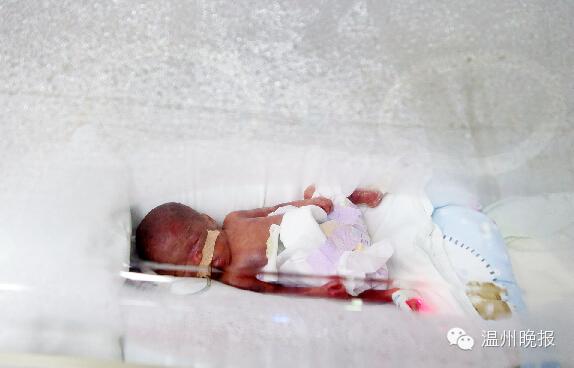 温州“巴掌婴儿”仅重790克 要在保温箱呆5个月