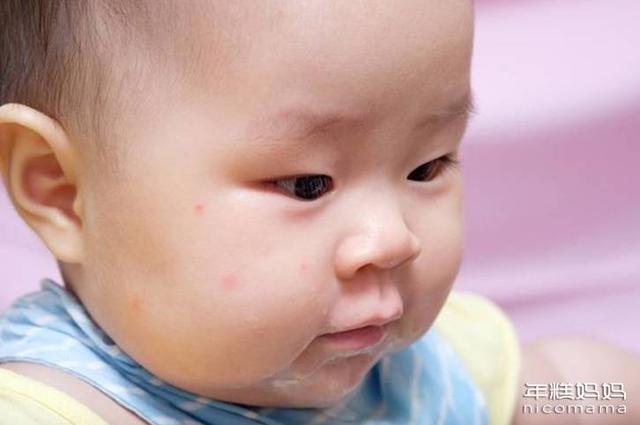 孩子因被蚊子咬生病? 多地现疫情或危及生命