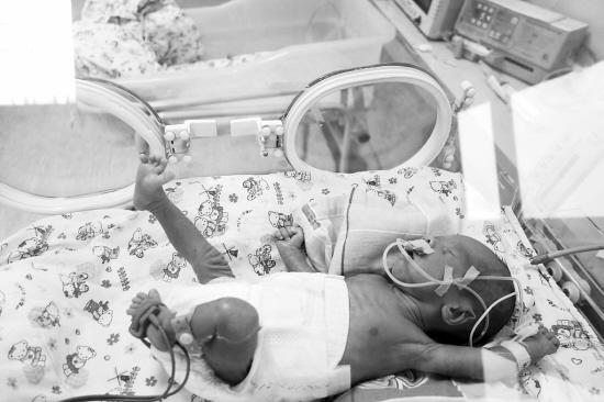 金华贫困户早产双胞胎 每天需花4000元无奈出院