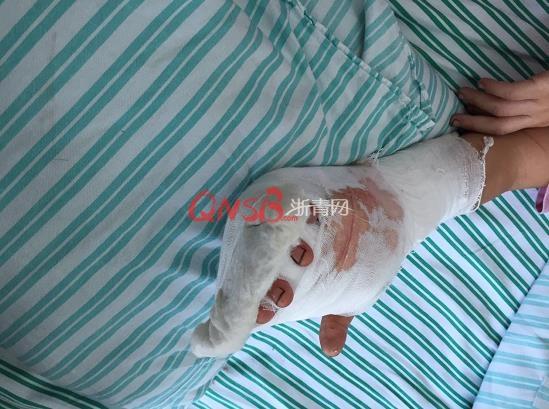 杭州一7岁女孩独自跑到工厂 被机器绞断4根手指