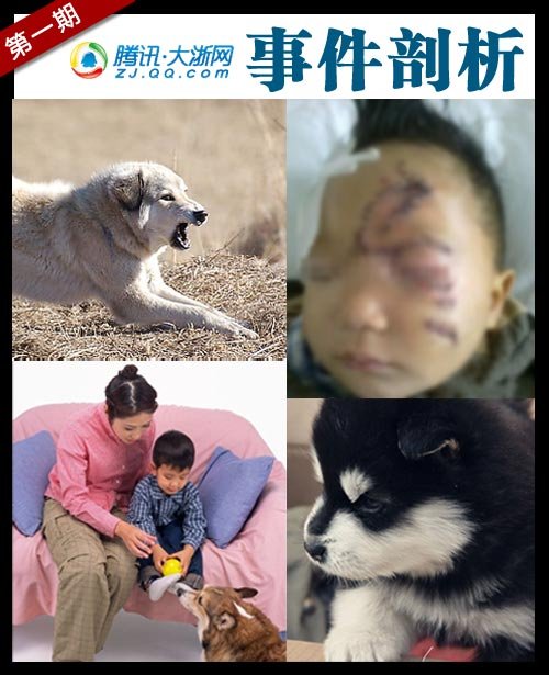 浙师大连续12人被狗咬伤…狗狗是人类忠实的朋友,但是近期,犬类伤人