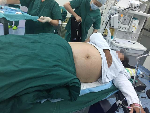 绍兴240斤孕妇生产 3名医务人员出动帮接生