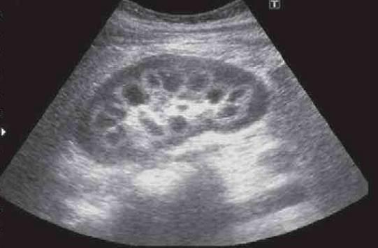 杭州妈妈第一胎出生3天猝死 二胎又查出这种病
